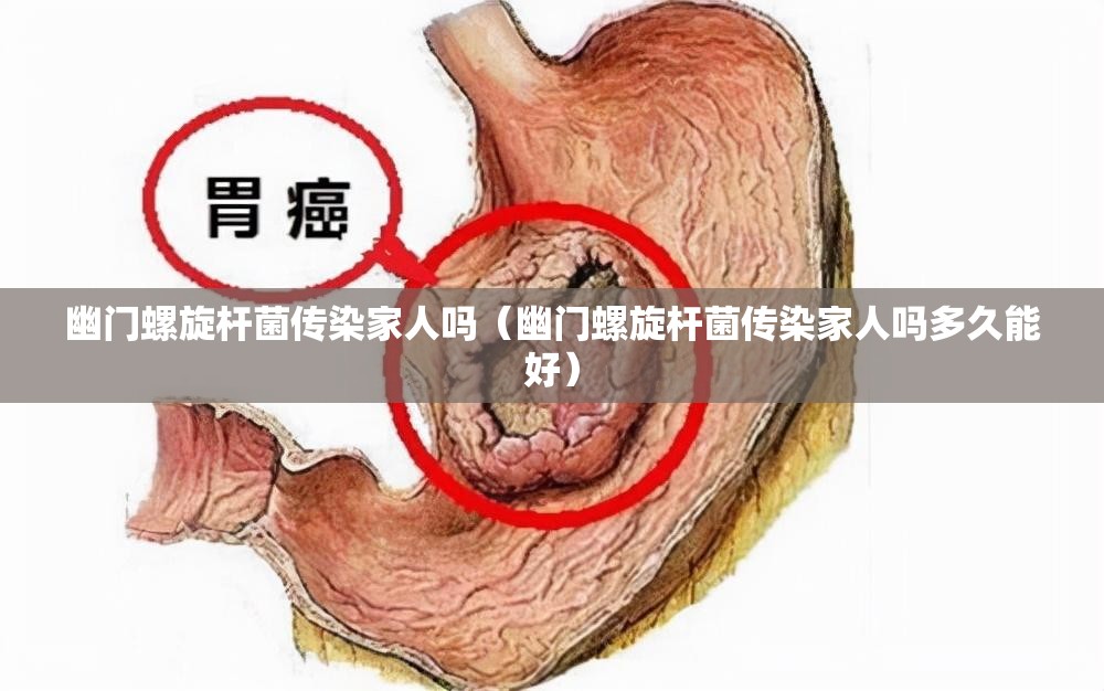 幽门螺旋杆菌传染家人吗（幽门螺旋杆菌传染家人吗多久能好）