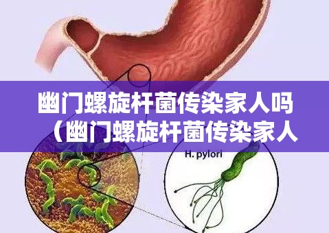 幽门螺旋杆菌传染家人吗（幽门螺旋杆菌传染家人吗多久能好）