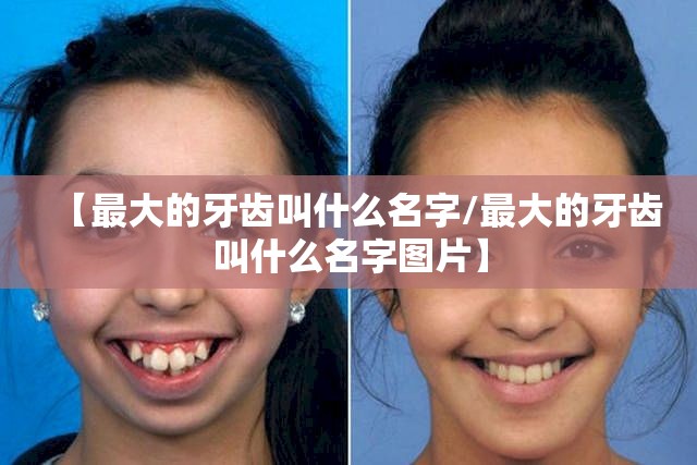 【最大的牙齿叫什么名字/最大的牙齿叫什么名字图片】