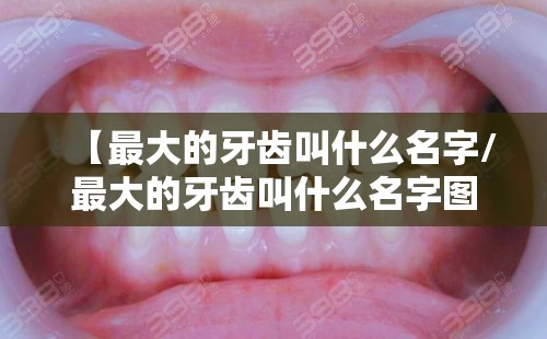 【最大的牙齿叫什么名字/最大的牙齿叫什么名字图片】