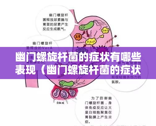 幽门螺旋杆菌的症状有哪些表现（幽门螺旋杆菌的症状有哪些表现怎样检查出来）